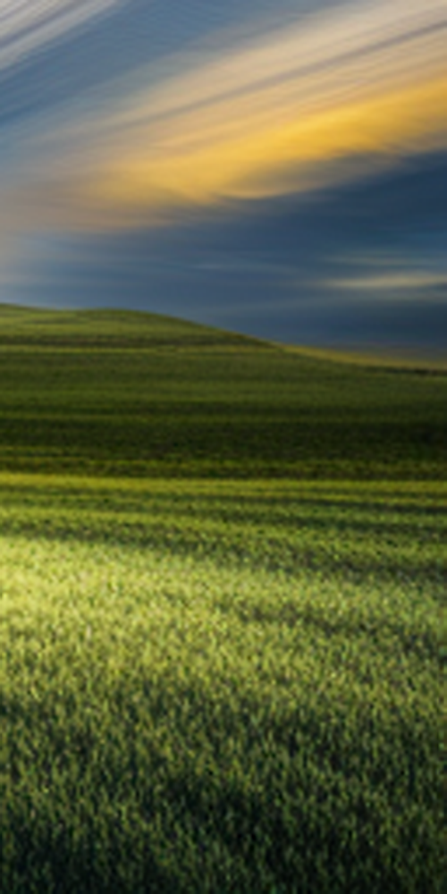 자연스러운 앞니라미네이트를 위한 방법 관련 이미지 18