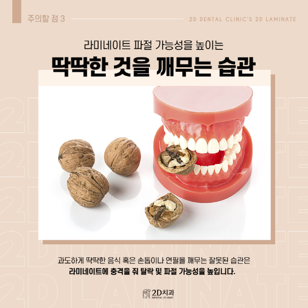 "이것만은 꼭 지켜줘" 라미네이트 시술 후 주의점 관련 이미지 4