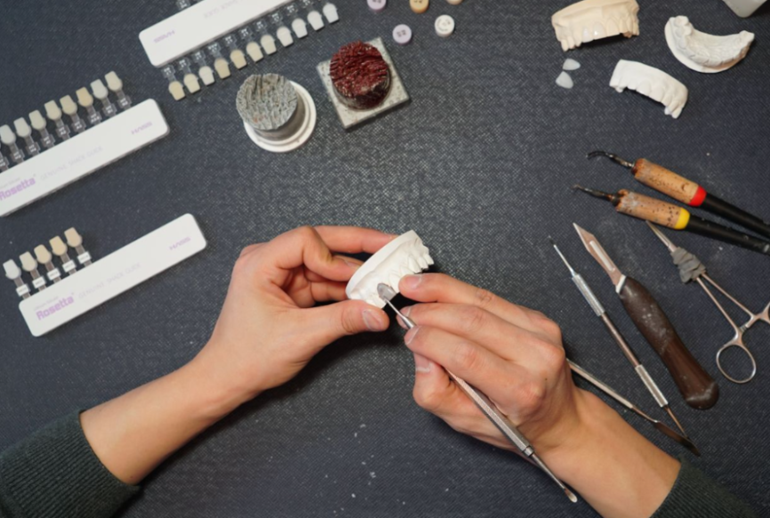 라미네이트치과 알아본다면? 관련 이미지 15