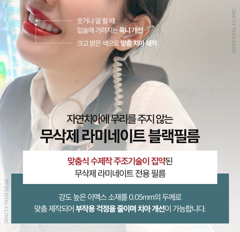 무삭제라미네이트부작용 치아미백치과 누런 이 치료, 망설여진다면 관련 이미지 4