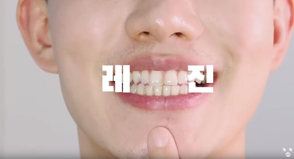 치과의사도 한 쎄라필름 유튜버 오대리Oderi님 리얼 후기! by.2D치과(투디치과) 관련 이미지 4