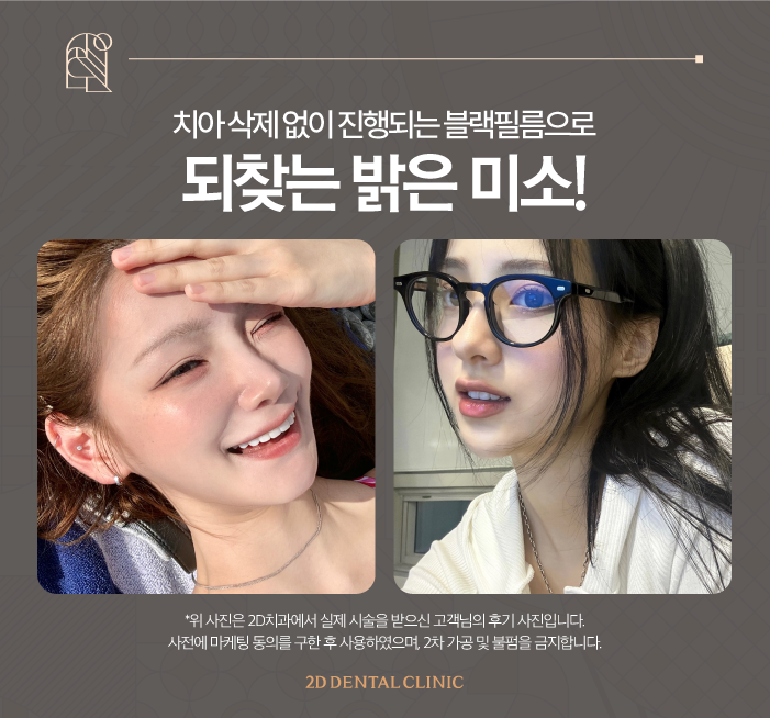 무삭제라미네이트비용 앞니 콤플렉스 극복은 블랙필름으로 관련 이미지 7