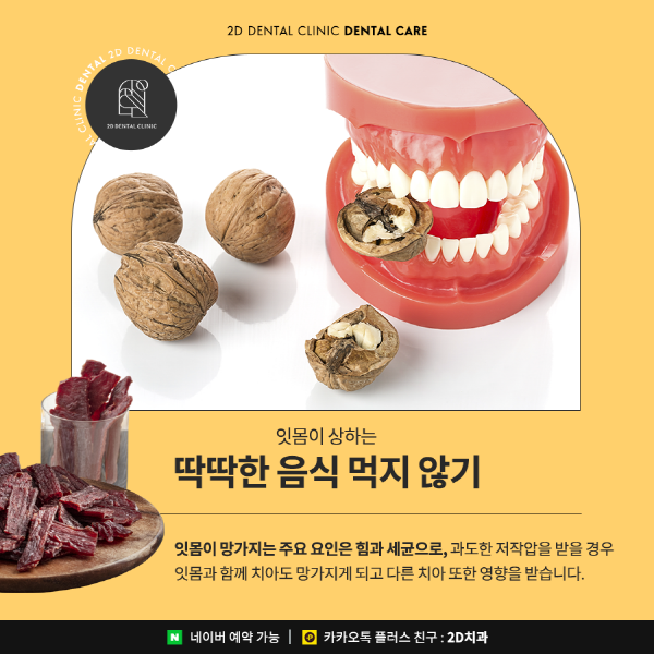 "칫솔질 잘하는데 왜 충치 생길까?" 치아건강 이렇게 관리하세요 관련 이미지 5