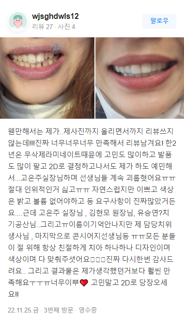 무삭제라미네이트 후기 모음 관련 이미지 15