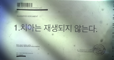 연예인라미네이트 치아삭제단점 보완한 치아삭제 없는 블랙필름 관련 이미지 7