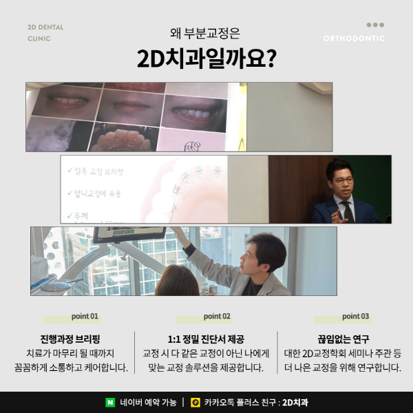 연예인처럼 티 안 나는 교정을 원한다면? 2D교정 관련 이미지 6