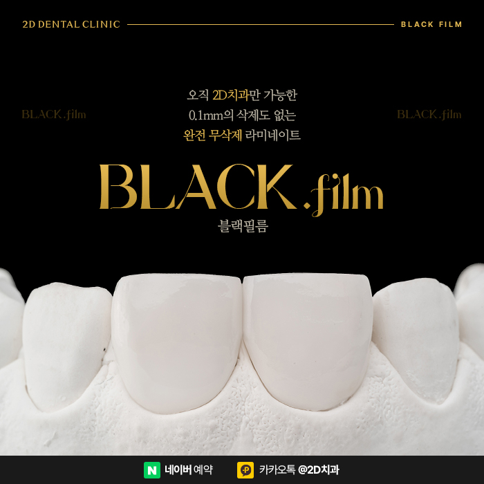 아랫니 라미네이트 가장 중요한 포인트는 삭제량, 완전 무삭제라미네이트 블랙필름 관련 이미지 1