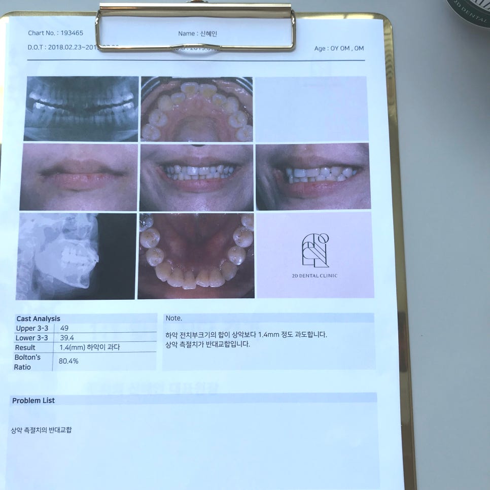 2D치과(투디치과) 교정일기ㅣ앞니덧니,반대교합 치아교정 완료!(ft.투디교정 전체교정) 관련 이미지 5