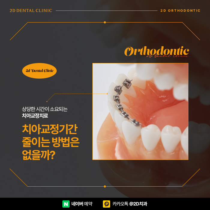 치아교정기간 단축시키기 위한 방법? 신논현 앞니부분교정 관련 이미지 2