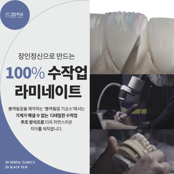 자연치 그대로 살렸다! 진짜 무삭제 라미네이트 <블랙필름> 관련 이미지 5