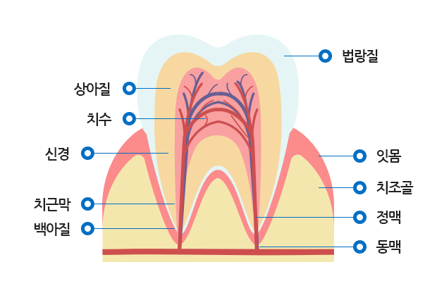 앞니가 깨졌을 때 치료방법은? 관련 이미지 3
