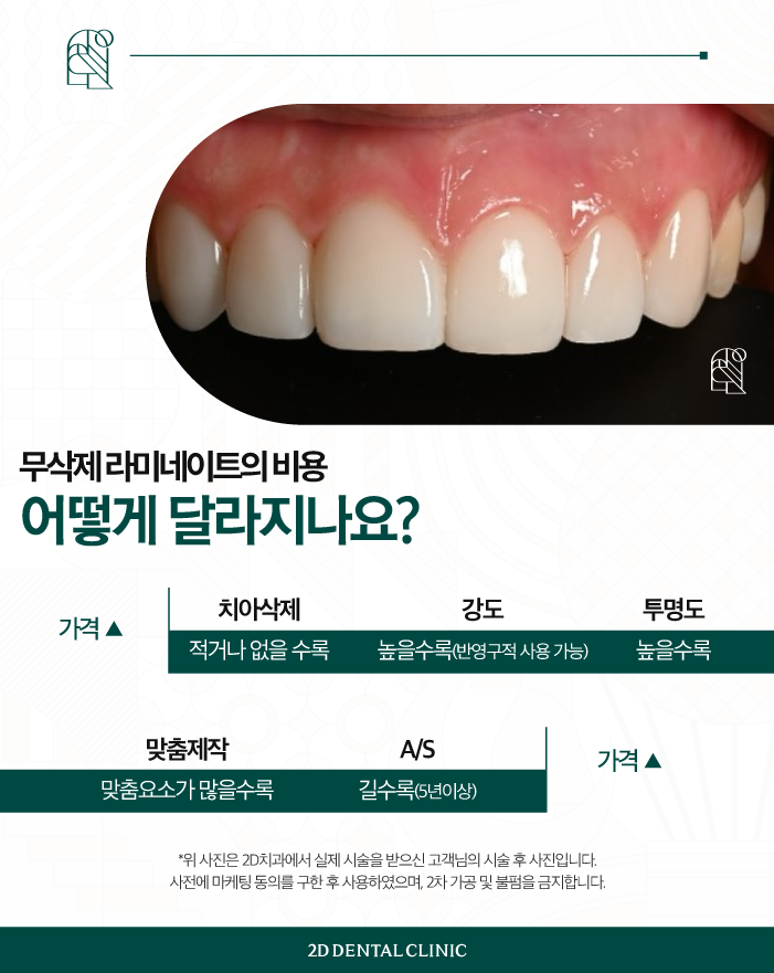 무삭제라미네이트비용 블랙필름 가격, 효과는 어떨까? 관련 이미지 5
