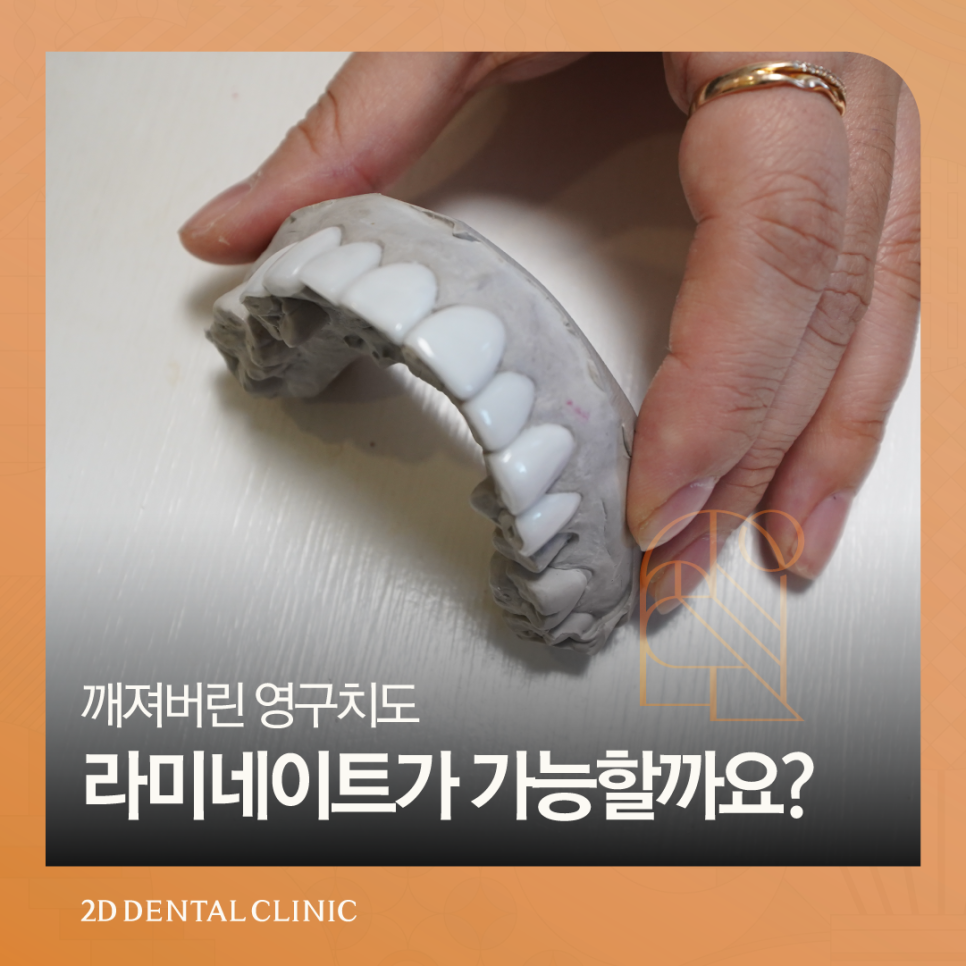 부산무삭제라미네이트 영구치앞니깨짐 어떻게 해야 좋을까요? 관련 이미지 1
