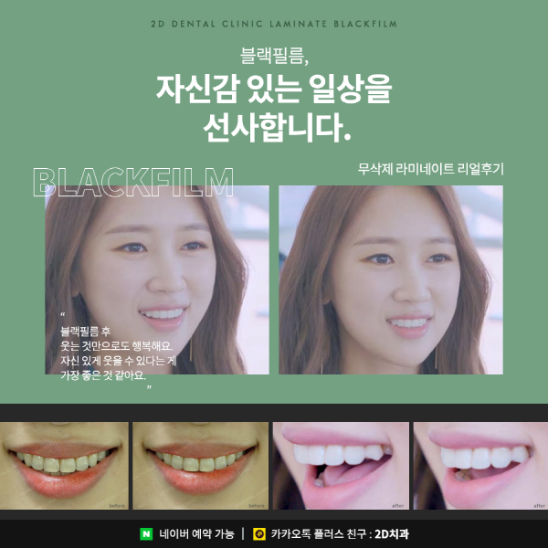 독보적인 기술력, 완전 무삭제 라미네이트 <블랙필름> 관련 이미지 2