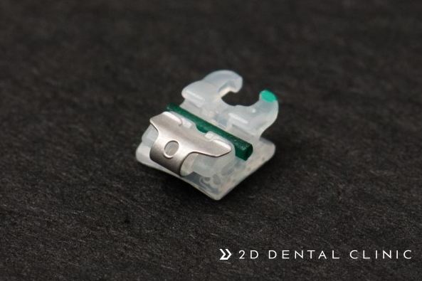 2D교정? 클리피씨? 자가결찰 브라켓! 강남 투디치과 관련 이미지 7