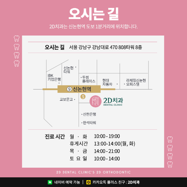 자세히 안보면 손해! 치아교정 할 때 관련 이미지 8