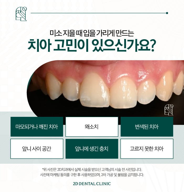 무삭제라미네이트비용 블랙필름 가격, 효과는 어떨까? 관련 이미지 3