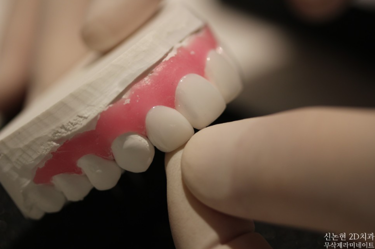 남유정 꼬북좌 거북왕 브브걸 유정 블랙필름 라미네이트 : 노빠꾸탁재훈에서? 관련 이미지 7