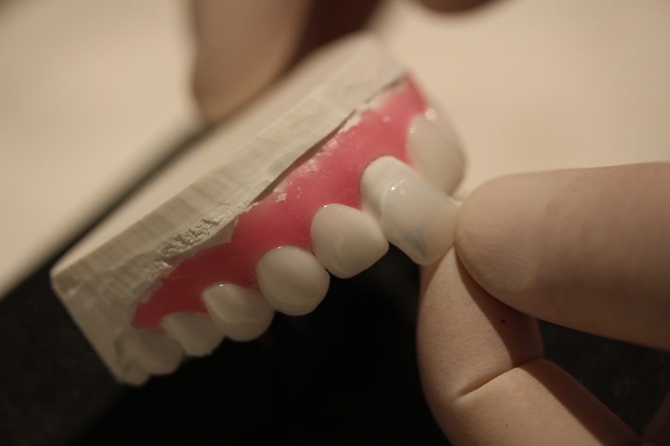 무삭제 라미네이트잘하는곳 잘 찾는 법! 관련 이미지 11