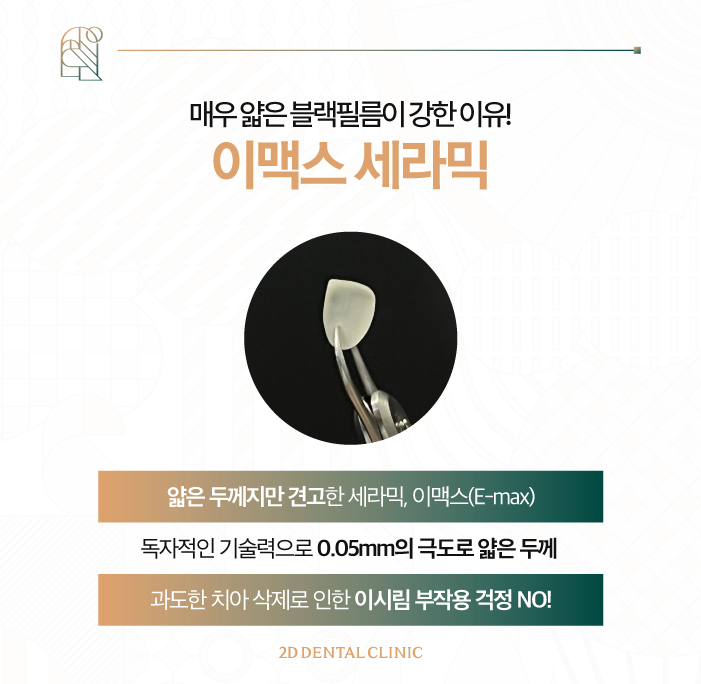 무삭제라미네이트부작용 치과라미네이트, A/S는? 관련 이미지 5