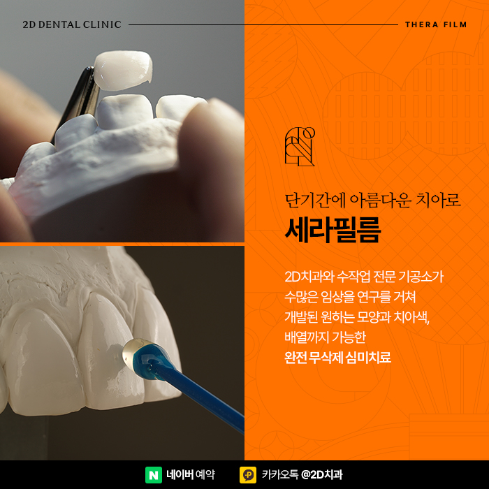 하얀치아로 면접 1분 자기소개 예시 임팩트 준비, 신논현 심미보철 관련 이미지 5