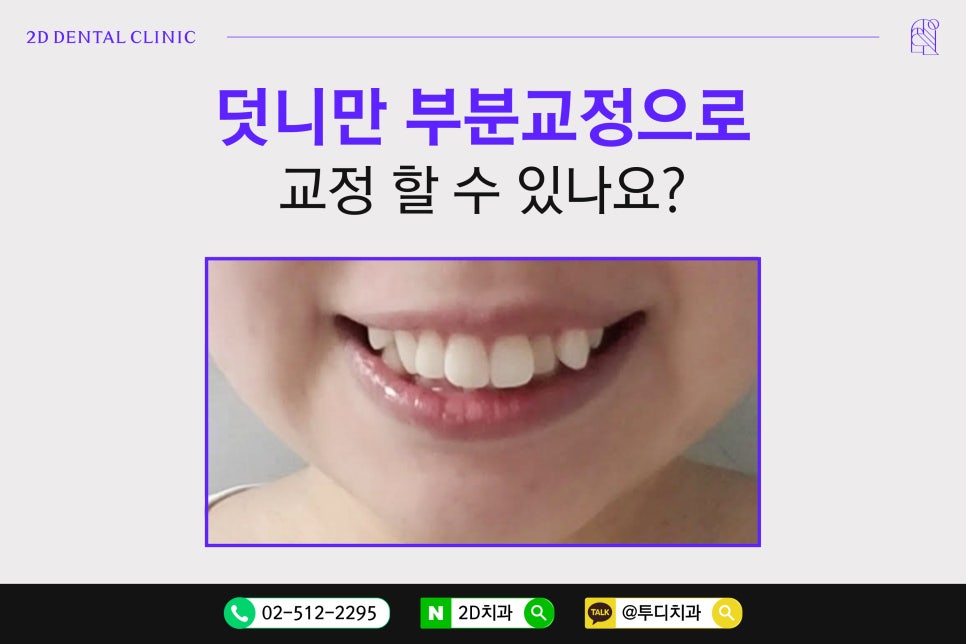 덧니만 부분교정으로 교정 할 수 있나요? 관련 이미지 1
