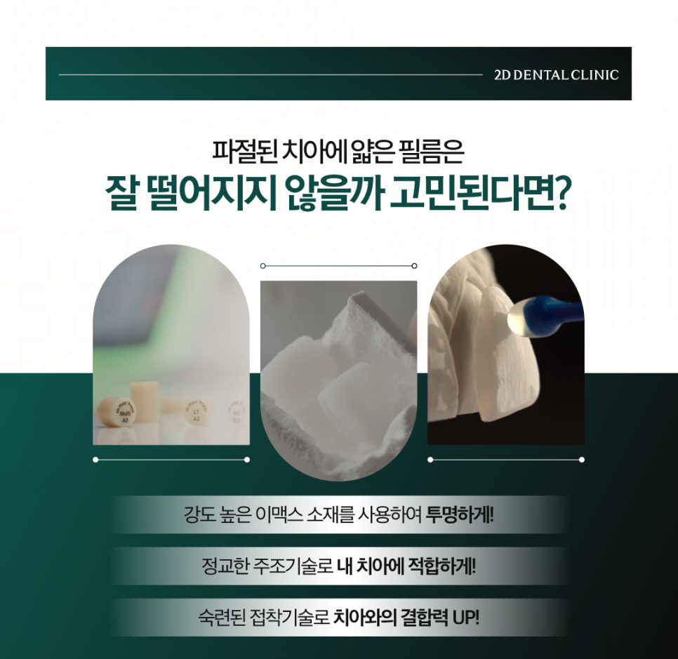 무삭제라미네이트가격 앞니파절 딱딱한 음식 먹다가 이가 부러졌다면 관련 이미지 5