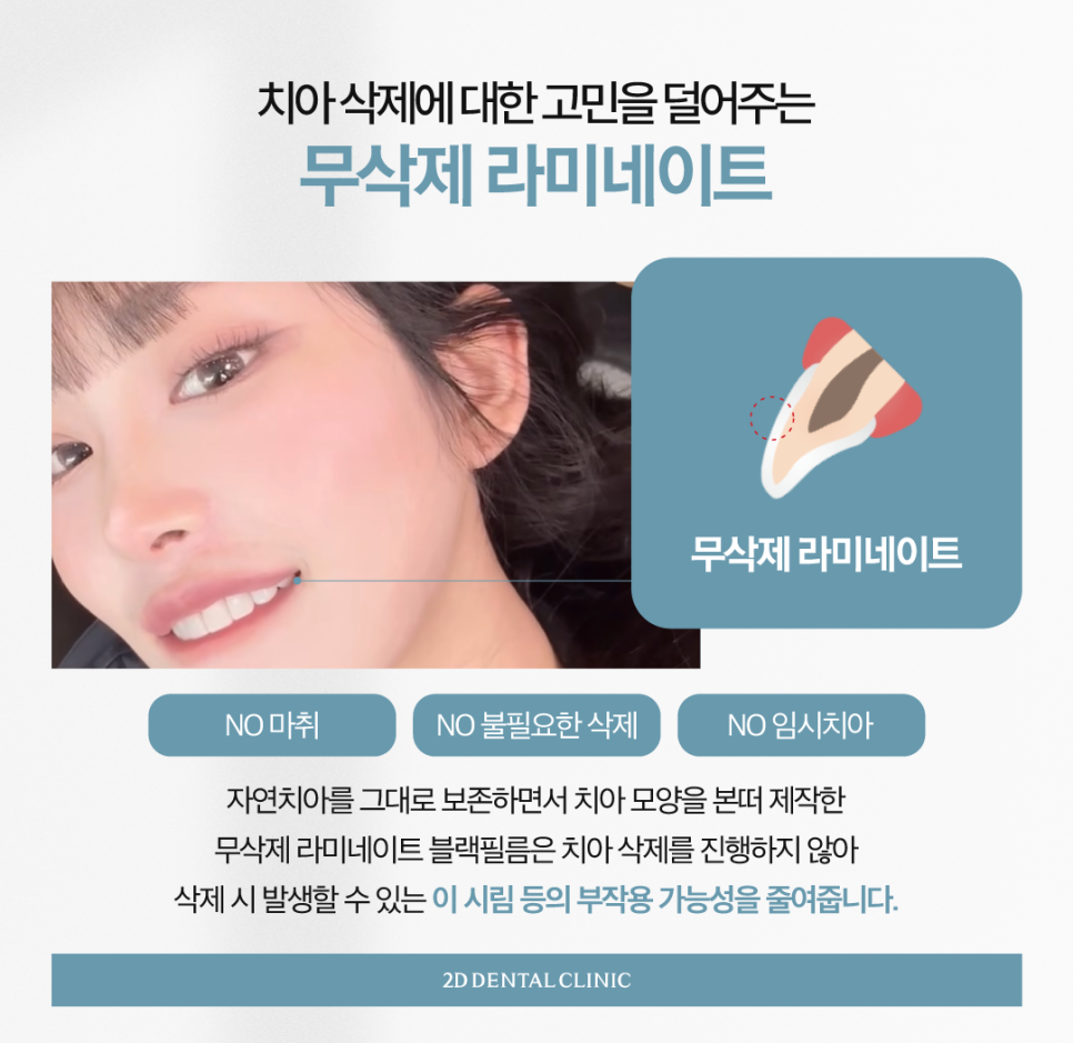치과라미네이트 치아성형 이 손상 줄이고 심미성 높이고 관련 이미지 4