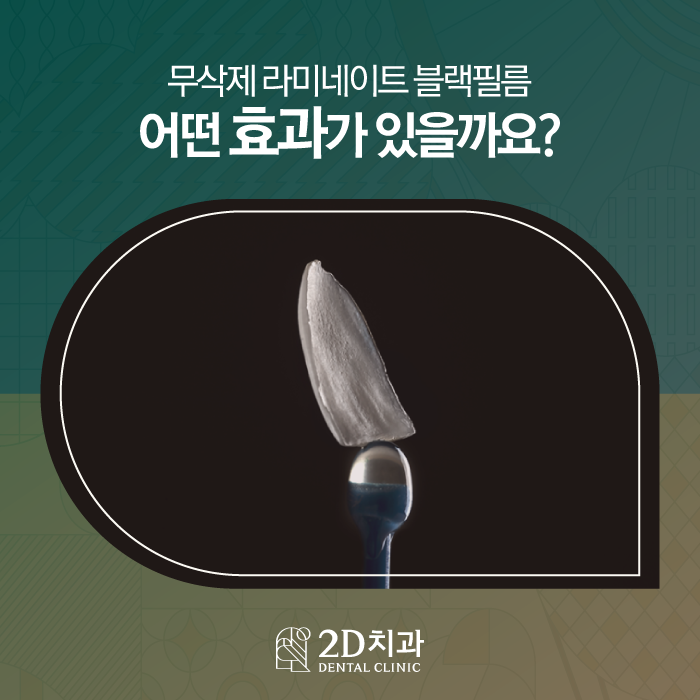 치아 무삭제 라미네이트 블랙필름 효과, 만족도는? 관련 이미지 1