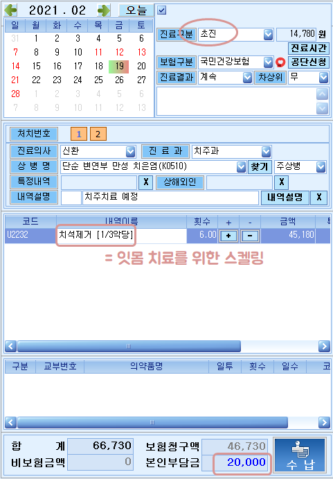 2021 스켈링 비용, 치석제거 스케일링 잇몸치료 가격 총정리 관련 이미지 12