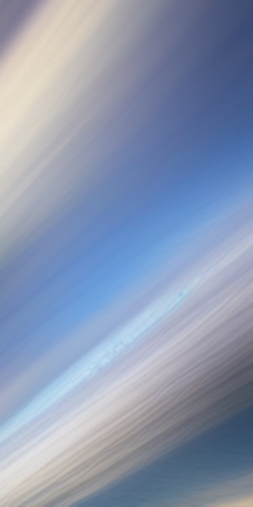 자연스러운 앞니라미네이트를 위한 방법 관련 이미지 14