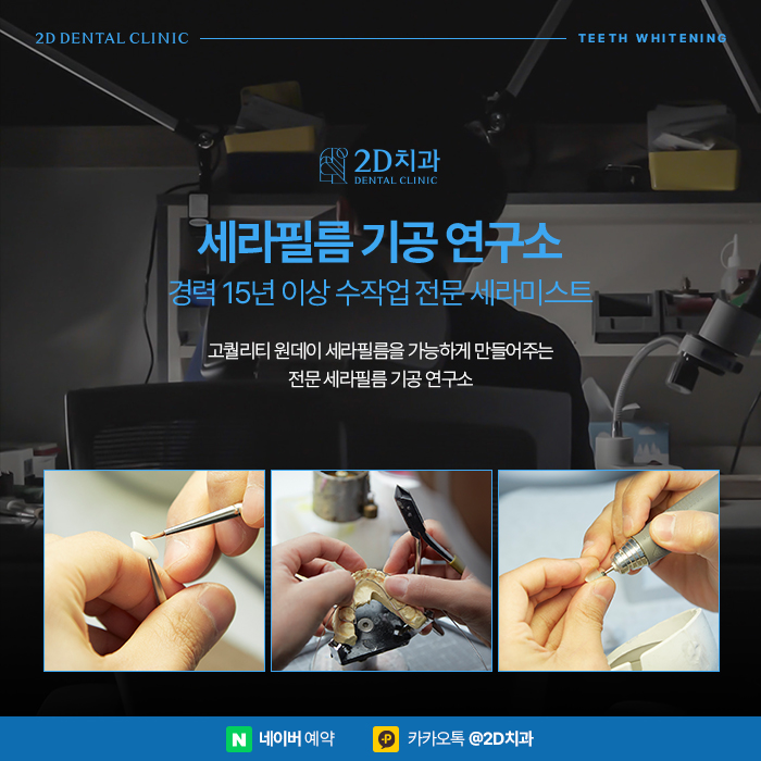 누렁니 원인 치아변색 방지하기 위해서는? 반포동치과 관련 이미지 5