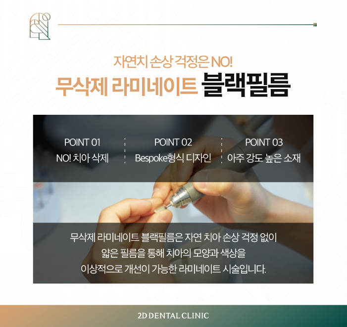 무삭제라미네이트부작용 치과라미네이트, A/S는? 관련 이미지 3