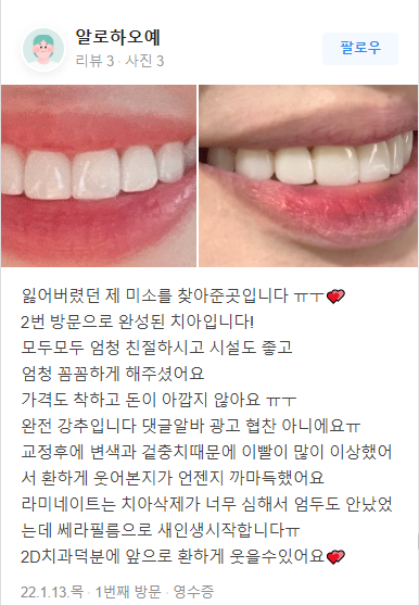 무삭제라미네이트 후기 모음 관련 이미지 5