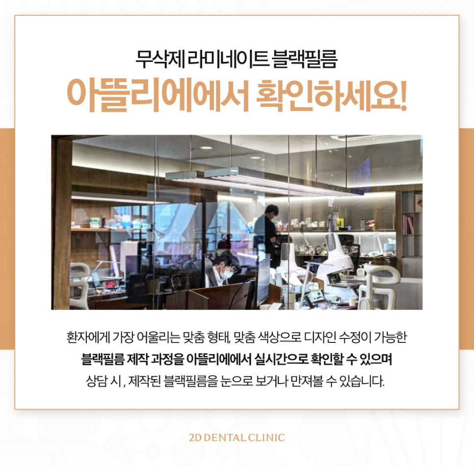 무삭제라미네이트후기 벌어진치아 해결하는 블랙필름 관련 이미지 6