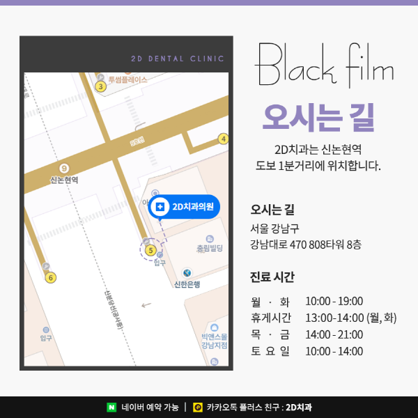 앞니 라미네이트 블랙필름의 효과성 A to Z 관련 이미지 8