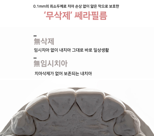 라미네이트 치료 전 체크해야할 부분은? 관련 이미지 3
