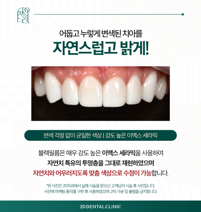 무삭제라미네이트 내 치아에 손상 없이! 관련 이미지 4