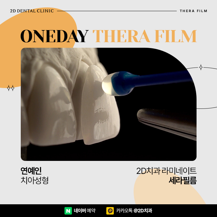 강남 연예인치아성형 환한 미소 부럽다면 원데이 세라필름 관련 이미지 1