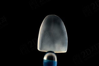 무삭제라미네이트부작용 블랙필름과 비교 관련 이미지 10