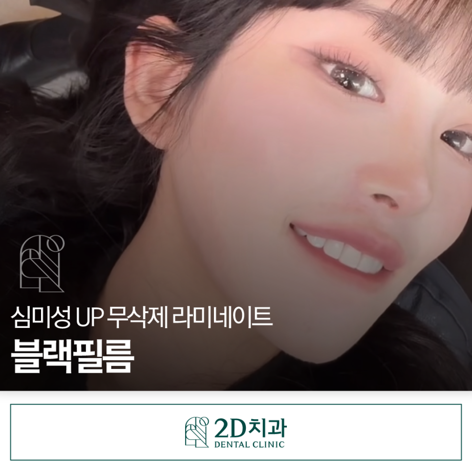 강남라미네이트 심미치료에 적합한 무삭제 블랙필름 관련 이미지 1