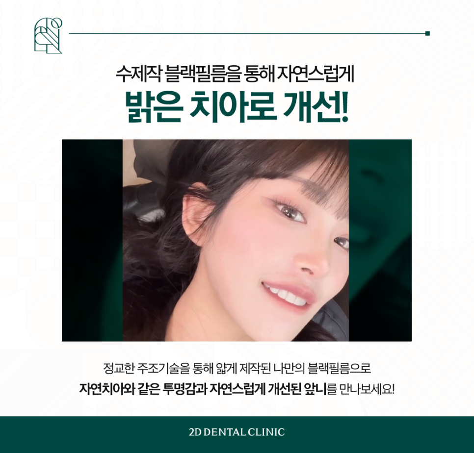 무삭제라미네이트가격 앞니변색도 개선 가능한 이유는? 관련 이미지 5