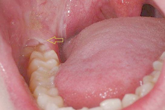 일요일에 문여는 치과  아파죽을것같은데 살려주세요 :: 신논현역 2D치과 관련 이미지 1