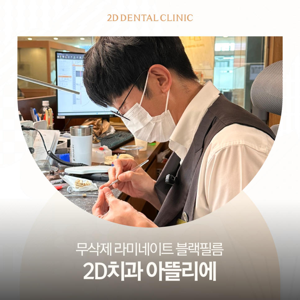 광주무삭제라미네이트 앞니성형 투디에서 디테일한 치아 개선을 관련 이미지 1