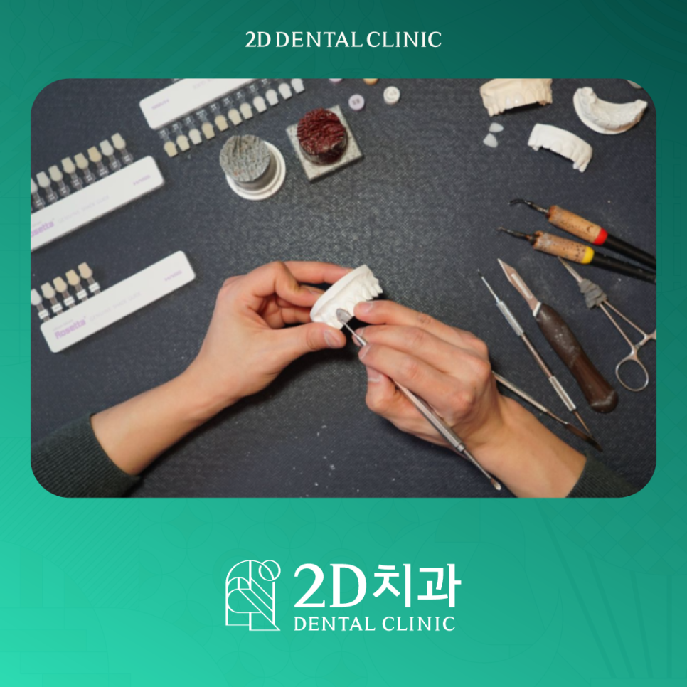 무삭제라미네이트부작용 치아부분변색 얼룩진 앞니 개선 관련 이미지 2