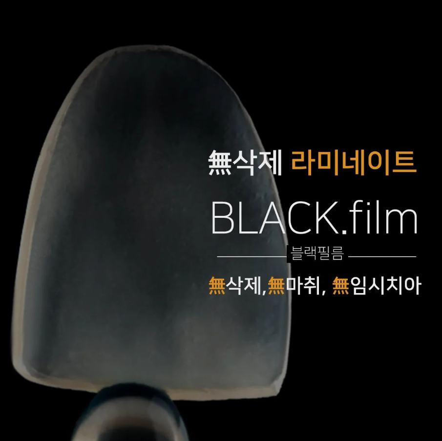 라미네이트 뜻 무삭제 라미네이트 블랙필름은 어떤 시술? 관련 이미지 7