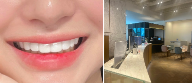 무삭제 라미네이트후기 살펴보기 관련 이미지 4