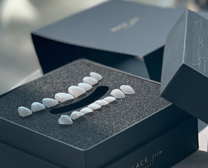 앞니왜소치 치아깨짐 무삭제라미네이트 블랙필름 관련 이미지 10