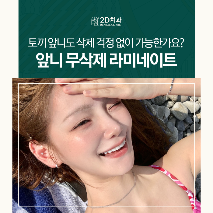 무삭제라미네이트가격 토끼 앞니도 개선이 되나요? 관련 이미지 1