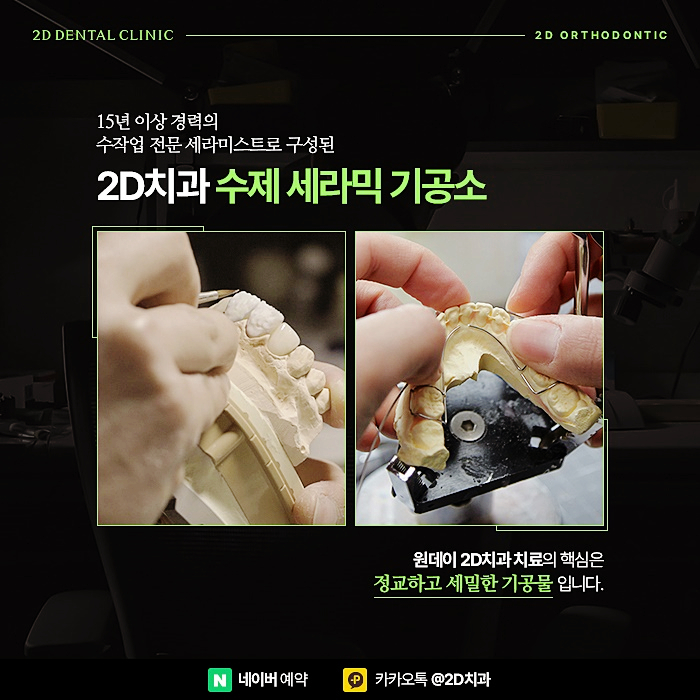 덧니부분교정 2D교정으로 해결, 강남 설측교정 관련 이미지 5
